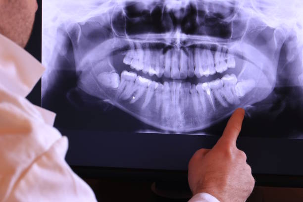 Best Walk-In Emergency Dentist in Kings Park, VA