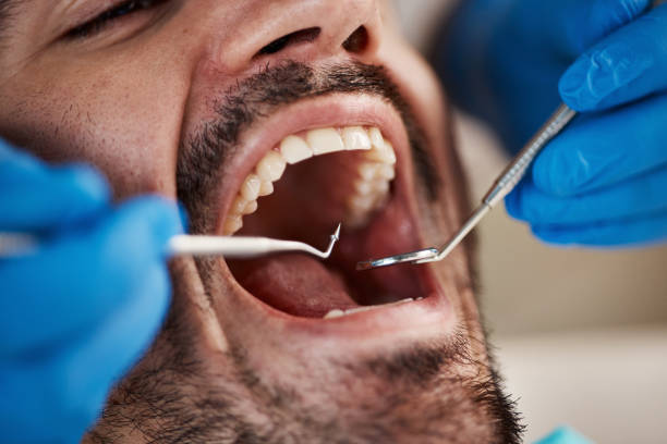 Best Pediatric Emergency Dentist in Kings Park, VA