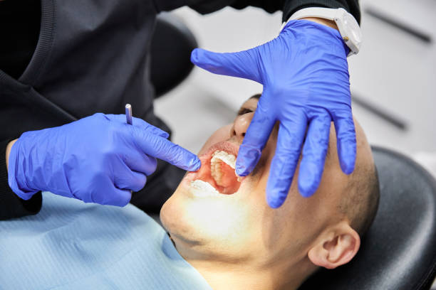 Best Emergency Wisdom Teeth Removal in Kings Park, VA